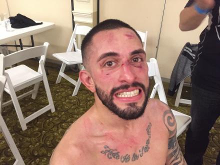 Marc post-fight beauty!
